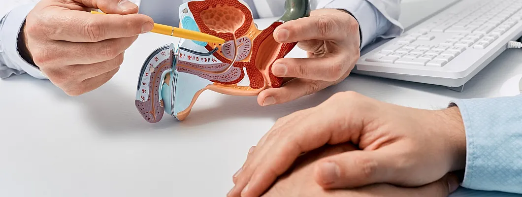 מגרי ערמונית | מדריך לפרוסטט לגברים