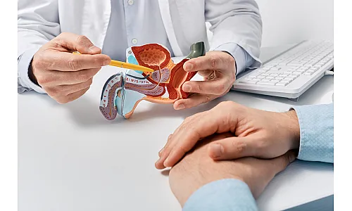 מגרי ערמונית | מדריך לפרוסטט לגברים